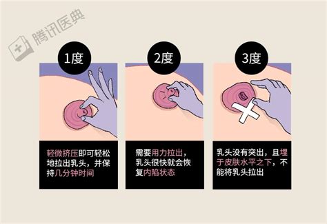 女人的乳頭|形状一人一样 女性乳头的12个秘密